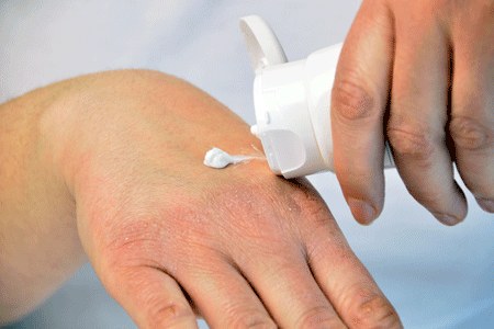 خشکی دست بعد از شستن دست و خشککردن ملایم پوست در فضای روشن
